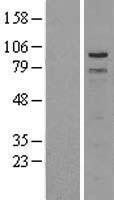 TPX2 Human Over-expression Lysate
