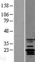 Claudin 14 (CLDN14) Human Over-expression Lysate