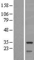 Mitochondrial dicarboxylate carrier (SLC25A10) Human Over-expression Lysate