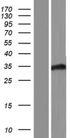 FBXO22 Human Over-expression Lysate