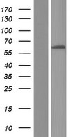 FBXL6 Human Over-expression Lysate