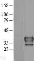 FUS2 (NAT6) Human Over-expression Lysate