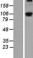 ALDH1L1 Human Over-expression Lysate