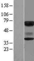 CABYR Human Over-expression Lysate