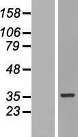 HNRPH3 (HNRNPH3) Human Over-expression Lysate