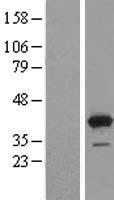GRHPR Human Over-expression Lysate