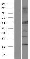 MLYCD Human Over-expression Lysate