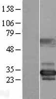 NUBP2 Human Over-expression Lysate