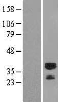 RYBP Human Over-expression Lysate
