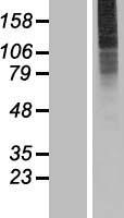 SLC35A3 Human Over-expression Lysate
