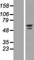 ZNF212 Human Over-expression Lysate