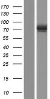 SLC27A5 Human Over-expression Lysate