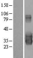 C20orf103 (LAMP5) Human Over-expression Lysate