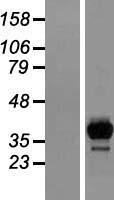 2 Hydroxy phytanoyl CoA lyase (HACL1) Human Over-expression Lysate
