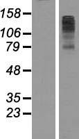 FBXL7 Human Over-expression Lysate