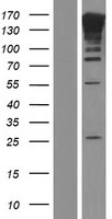 AIP1 (MAGI2) Human Over-expression Lysate