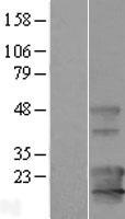 KCNE1L (KCNE5) Human Over-expression Lysate