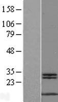 MYCBP Human Over-expression Lysate