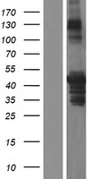 PICK1 Human Over-expression Lysate