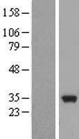 EB3 (MAPRE3) Human Over-expression Lysate