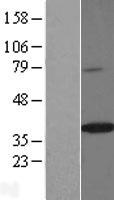 SPON2 Human Over-expression Lysate