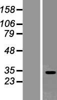 SEC22L2 (SEC22A) Human Over-expression Lysate