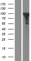 STAT5B Human Over-expression Lysate