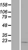 TIMM9 Human Over-expression Lysate