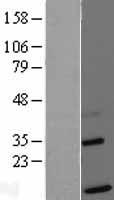 TIMM13 Human Over-expression Lysate