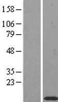 TIMM10 Human Over-expression Lysate