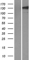 TLL1 Human Over-expression Lysate