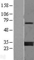 14 3 3 gamma (YWHAG) Human Over-expression Lysate