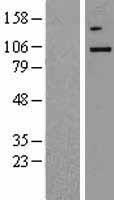 TBK1 Human Over-expression Lysate