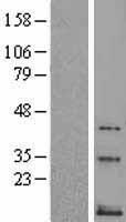 Neurokinin B (TAC3) Human Over-expression Lysate