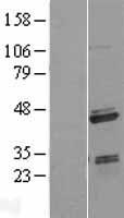 SAP30BP Human Over-expression Lysate