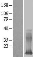 Galectin 13 (LGALS13) Human Over-expression Lysate