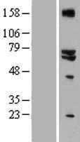 GLS2 Human Over-expression Lysate