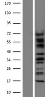 CTNNA3 Human Over-expression Lysate