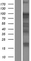UHRF1 Human Over-expression Lysate