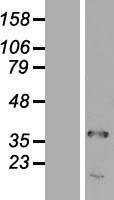 TRA2A Human Over-expression Lysate