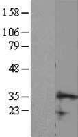 CCDC106 Human Over-expression Lysate