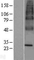 UBIAD1 Human Over-expression Lysate