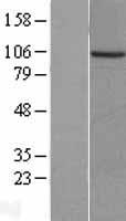 PKN beta (PKN3) Human Over-expression Lysate