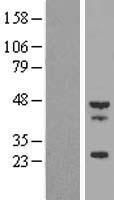 Tropomodulin 4 (TMOD4) Human Over-expression Lysate