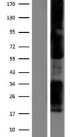TBX21 Human Over-expression Lysate