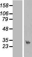 RPA4 Human Over-expression Lysate