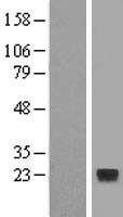 TIMM22 Human Over-expression Lysate