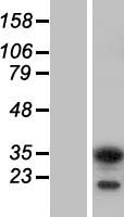 Activator of basal transcription 1 (ABT1) Human Over-expression Lysate