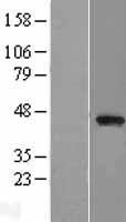 PARVB Human Over-expression Lysate