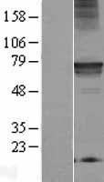 RMC1 Human Over-expression Lysate